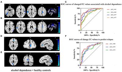 Functional Connectivity of Nucleus Accumbens and Medial Prefrontal Cortex With Other Brain Regions During Early-Abstinence Is Associated With Alcohol Dependence and Relapse: A Resting-Functional Magnetic Resonance Imaging Study